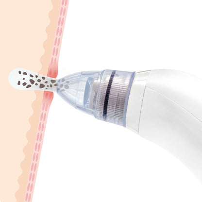 Pore-Off Electric Blackhead Remover – Deep Pore Vacuum Facial Cleaner